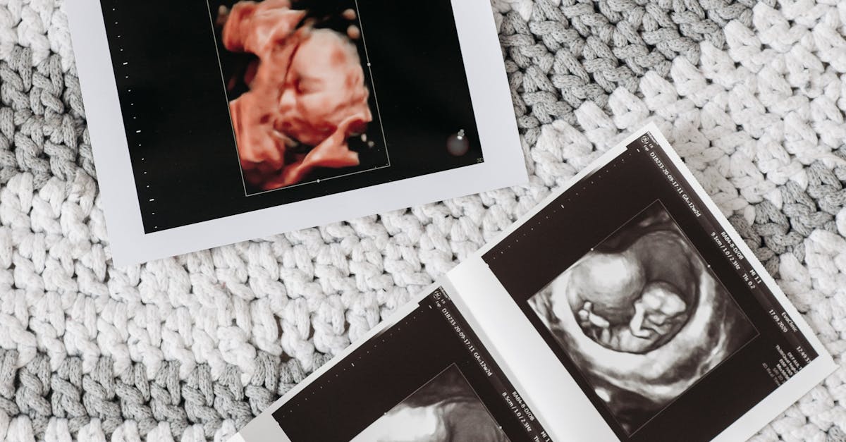 Genetik Faktörlerin IVF Başarısı Üzerindeki Rolü