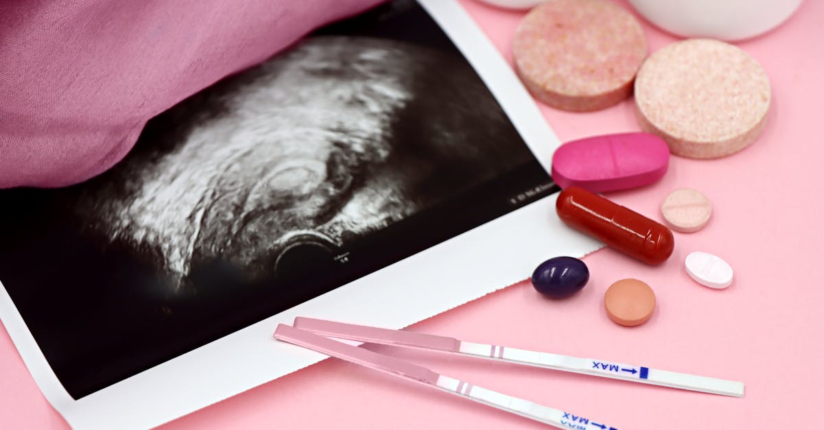 Tüp Bebek Tedavisinde Maliyetin Anatomisi
